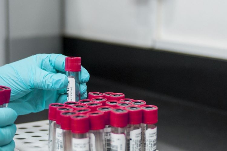 Laboratoře na Slovensku čelí rekordní pokutě za kartel