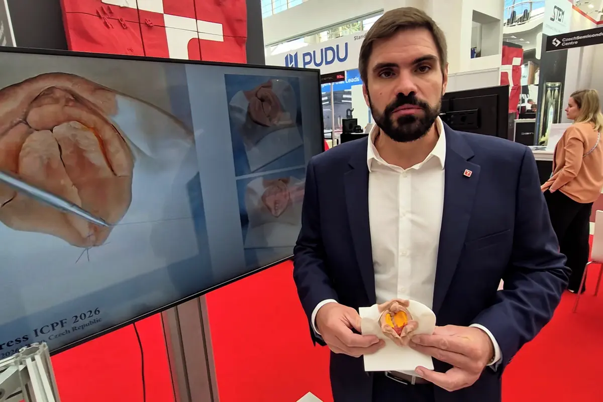 Unikátní silikonové modely pomohou lékařům nacvičit si operace rozštěpů