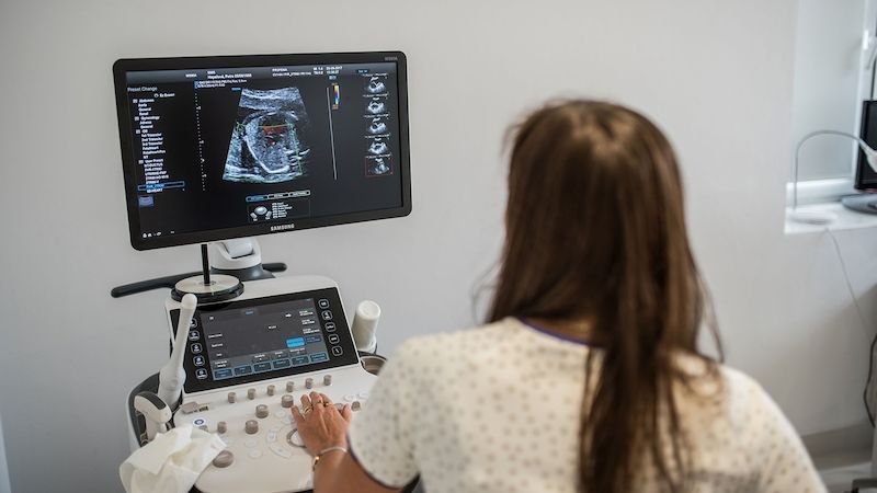 Tkáň z nádorů získávají lékaři pomocí ultrazvuku. Určí i rozsah nemoci