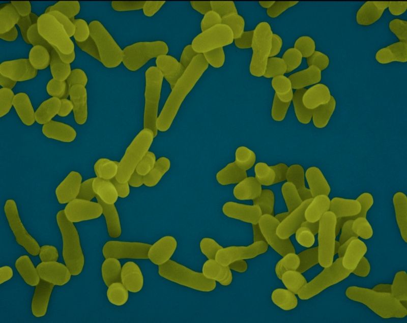 Fotografie bakterie Mycobacterium tuberculosis, která nejčastěji způsobuje tuberkulózu. Bakterie velká asi dva mikrometry je na snímku zvětšená 3700krát.