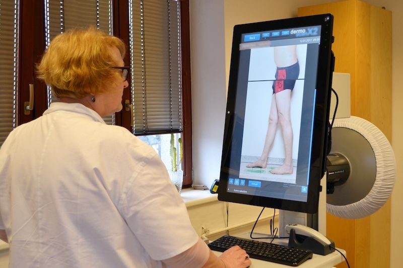 Přístroj umožňuje odborníkům vyšetřovat nově znaménka prostřednictvím celoplošného skenování těla.