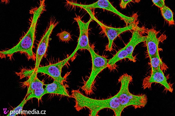 Snímek rakovinových buněk