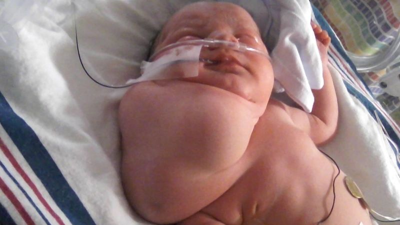 Dvouměsíční Peyton Marie Kirbyová krátce před náročnou operací