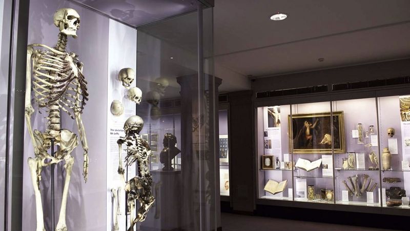 Charles Byrne se stal jedním z exponátů muzea Královské akademie chirurgů v Londýně