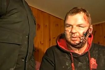 Dmytro Bulatov má pořezaný obličej