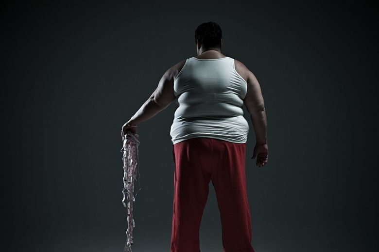 Obezita je spojená i s nedostatkem sportovních aktivit.