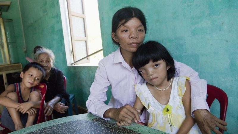 Le Thi Thu s devítiletou dcerou Nguyen Thy Li. Dívka má vrozené vady, její otec byl zasažen defoliantem Agent Orange. Otravou trpí i matka.