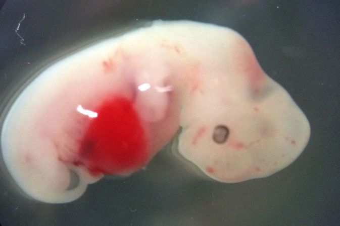 Čtyřtýdenní prasčí embryo s lidskými buňkami
