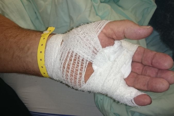 Ošetřená zranění na ruce jednoho z napadených pacientů