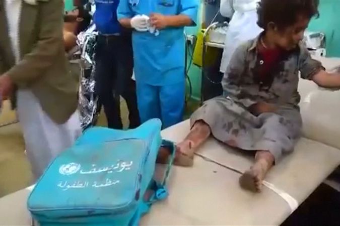 BEZ KOMENTÁŘE: Při náletech na Jemen umíraly i děti, další byly zraněny