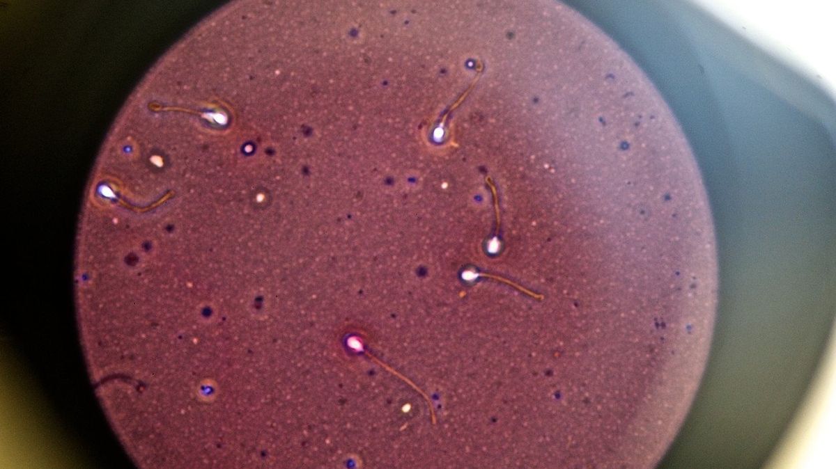 Spermie pod mikroskopem. Ilustrační foto
