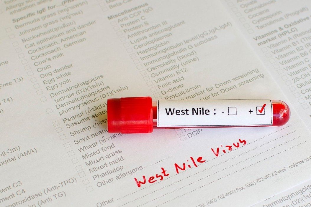 Pozitivní test na západonilský virus