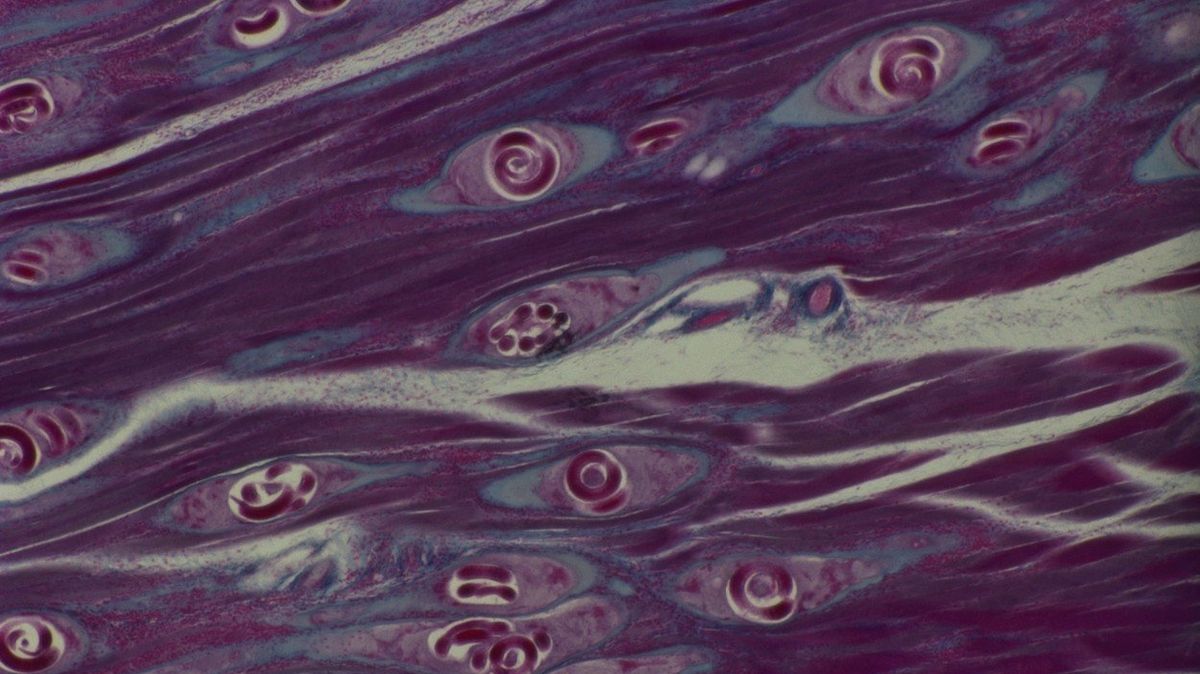 Трихинелла (Trichinella spiralis). Яйца трихинеллы под микроскопом. Трихинелла Спиралис под микроскопом.