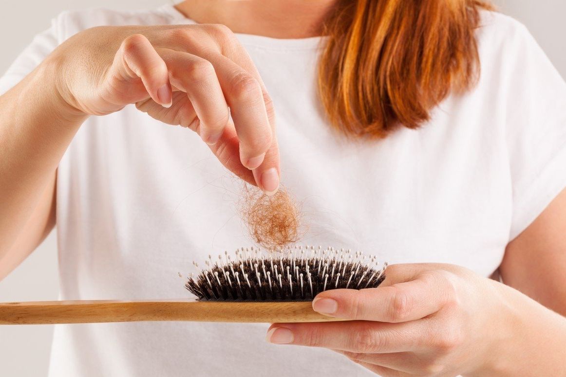 Ztátu vlasů špatně prožívají ženy i muži.