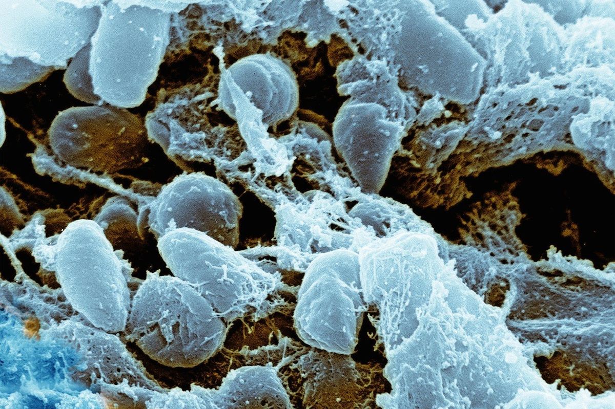 Ilustrační obrázek morové bakterie Yersinia pestis