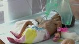 V Indii našli zaživa pohřbenou novorozenou holčičku