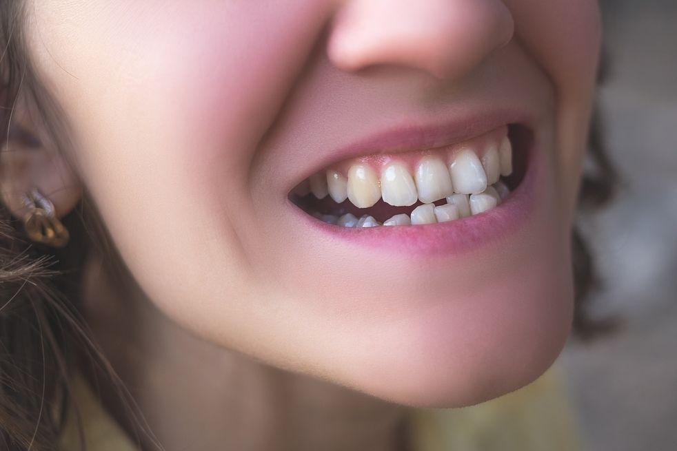 Křivé zuby nejsou jen estetický problém.