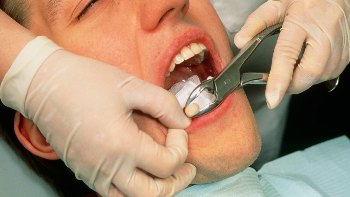 I zubaři chybují. Studie odhalila počet omylů, jaké nikdo nechce zažít