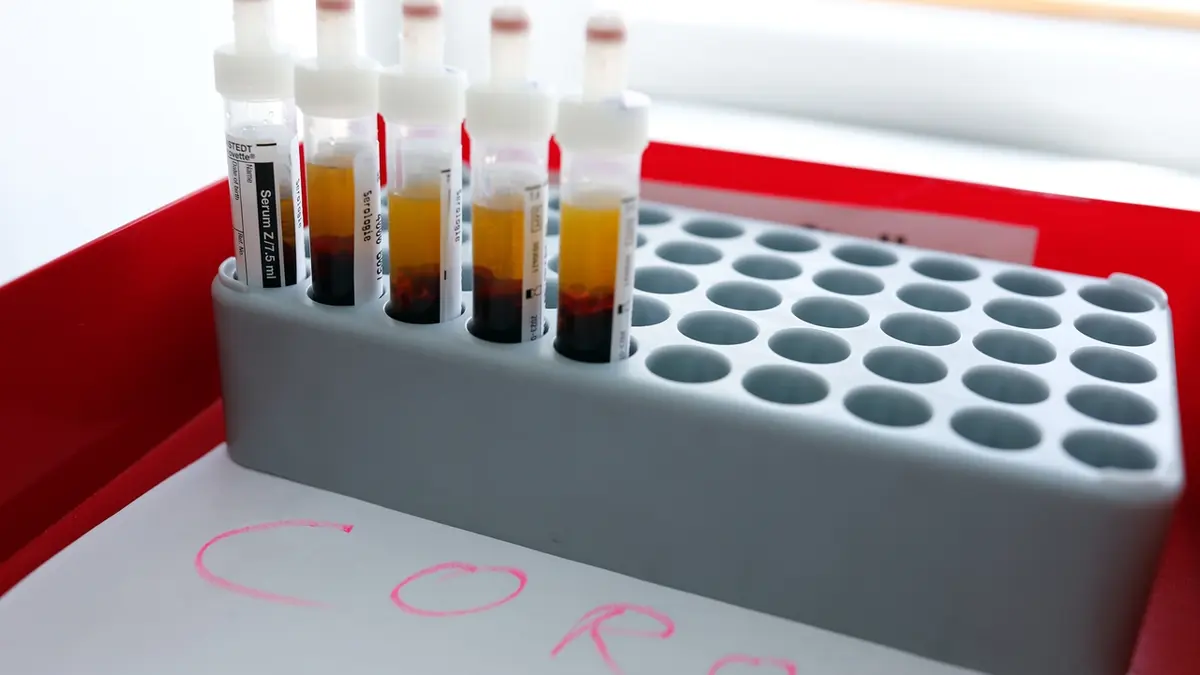 Vedci Bez Opatreni By Koronavirus Zabil 40 Milionu Lidi Nakazen By Byl Cely Svet Novinky Cz