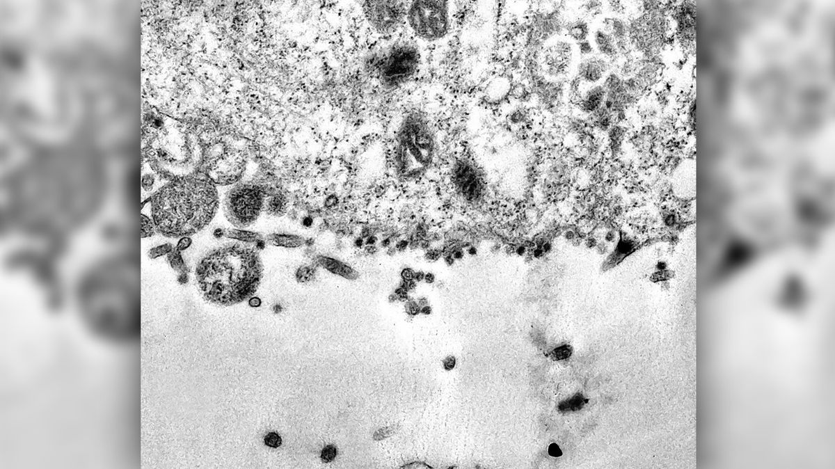 Ковид пошел. Вирус SARS-cov-2 под микроскопом. Вирус Covid 19 под микроскопом. Коронавирус SARS cov 2 под микроскопом. Covid-19 под микроскопом.