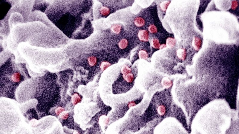 Napadení zdravé tkáně virem HIV