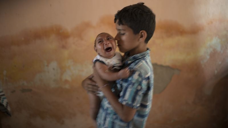 Desetiletý chlapec drží svého dvouměsíčního bratra, který se narodil s mikrocefalií.