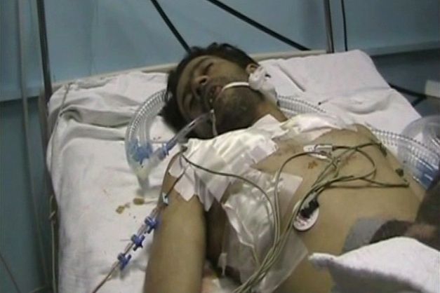 Jeden ze zraněných demonstrantů v nemocnici ve městě Dará (záběr z videa)