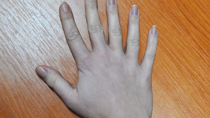 На 1 руке 6 пальцев. Раскладка 6 пальцев стандлффф. 6 Пальцев нормально или нет.