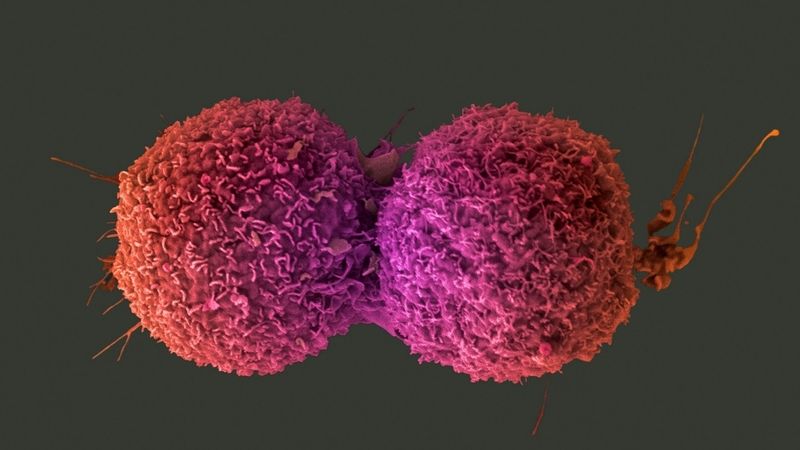 Kultivované buňky rakoviny plic.