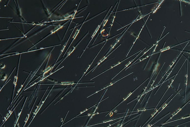Mikroskopický snímek rozsivek. Jde o ilustrační foto, nejedná se tedy o konkrétní druh v článku uváděné rozsivky Pseudo-nitzschia multiseries.