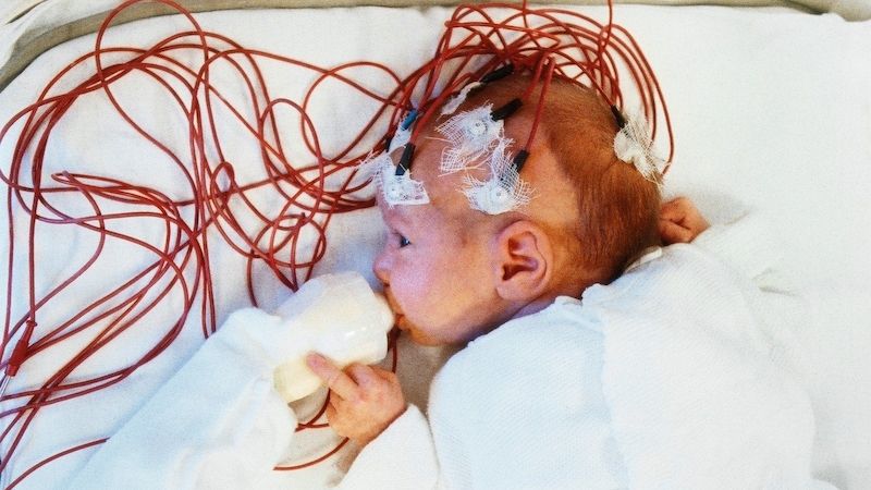 První záchvaty epilepsie se mohou objevovat již v kojeneckém věku.