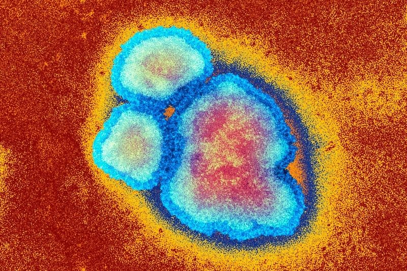 Virus spalniček (Morbilli)