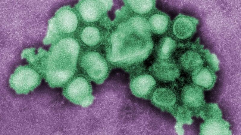 Snímek viru H1N1 pořízení elektronovým mikroskopem