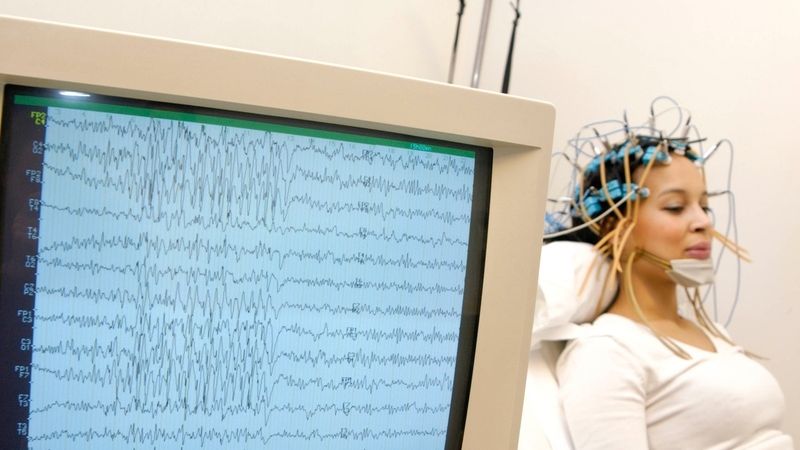 EEG zachycuje aktuální elektrické aktivity mozku.
