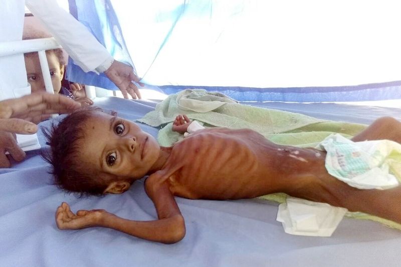 V Jemenu je ohroženo hladem přes pět miliónů dětí.