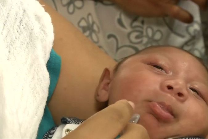 BEZ KOMENTÁŘE:  V Brazílii se rodí více dětí s mikrocefalií