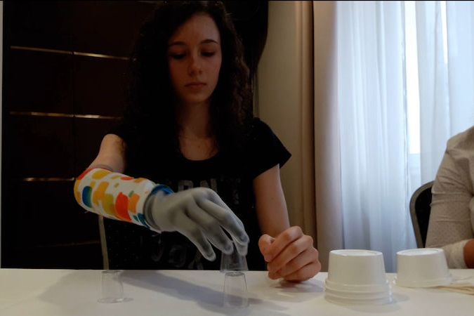 Žena s bionickou protézou na ruce