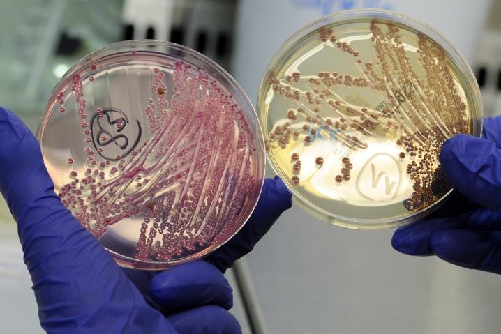 ČTVRTEK: Zaměstnanec mikrobiologické laboratoře v Hamburku ukazuje enterohemorhagickou bakterií Escherichia coli (EHEC).
