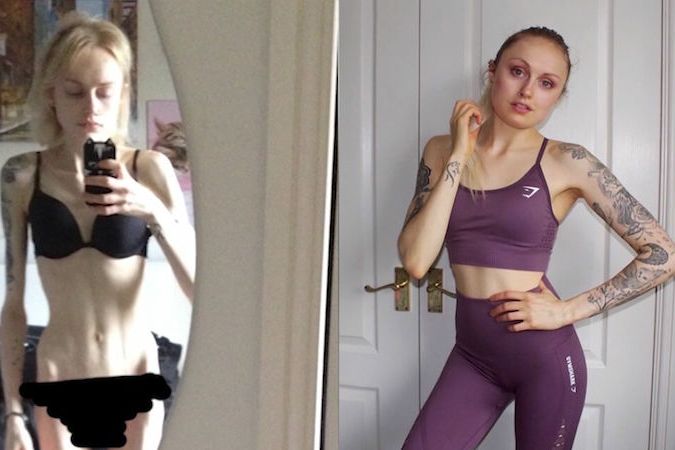 BEZ KOMENTÁŘE: Anorektička vážící 35 kg po sedmi letech přibrala a stala se z ní fitness trenérka