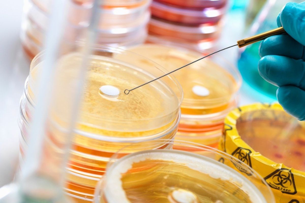 Vědci testují v Petriho miskách nová antibiotika. Ilustrační foto