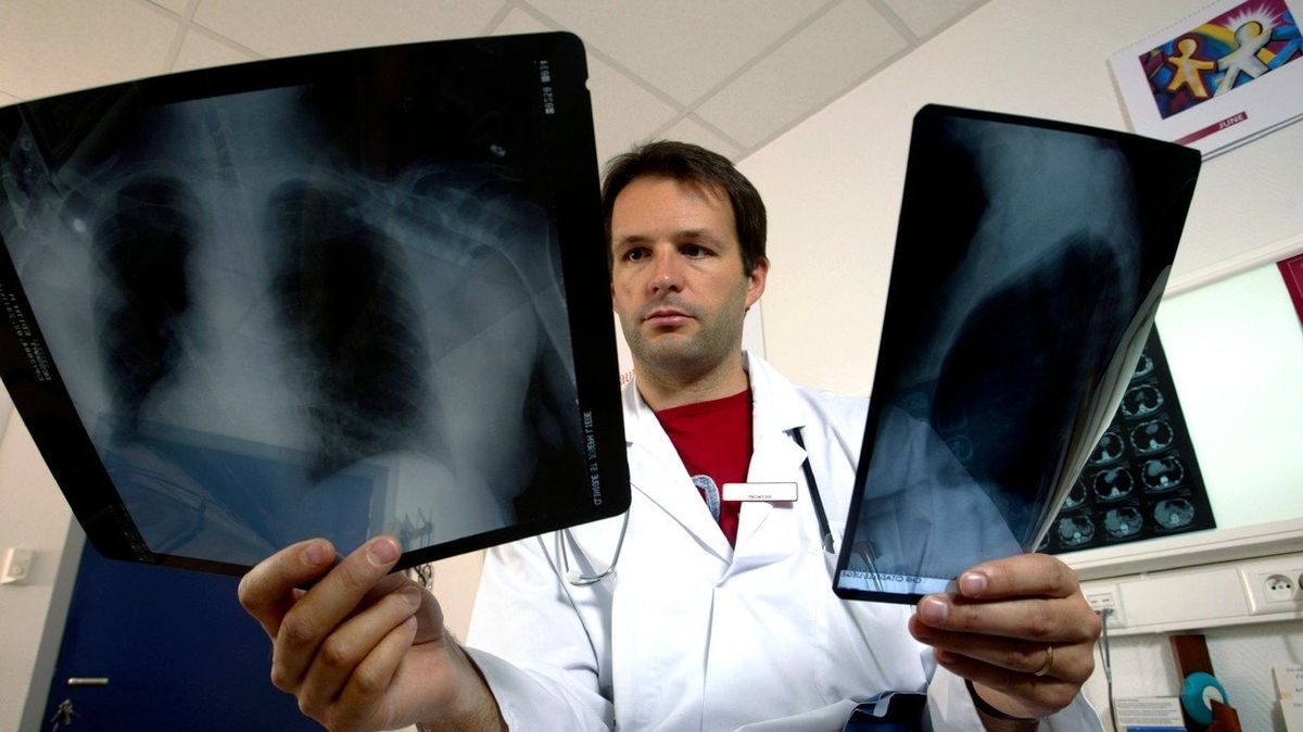 Lékař se snímky plic. Ilustrační foto