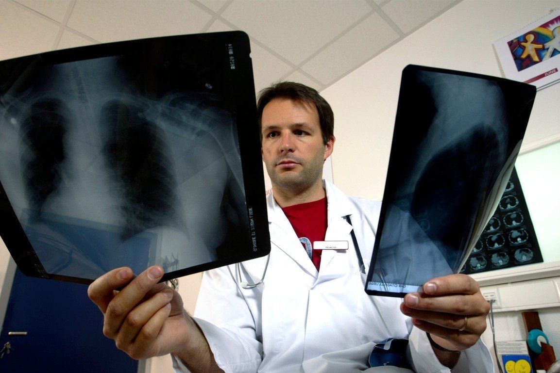 Lékař se snímky plic. Ilustrační foto