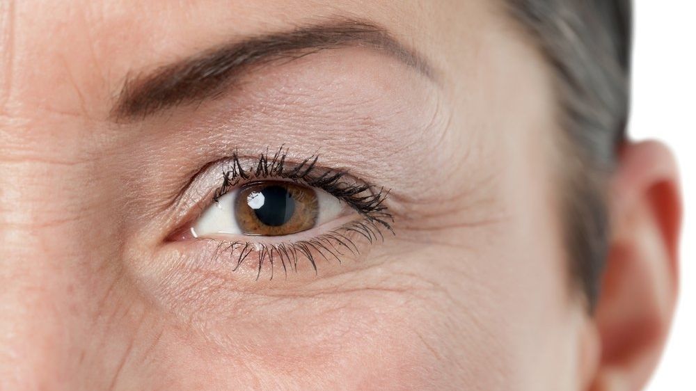Pokles horního víčka činí jedince vzhledově staršího, než ve skutečnosti je. Může i za zvýšenou únavu očí. 