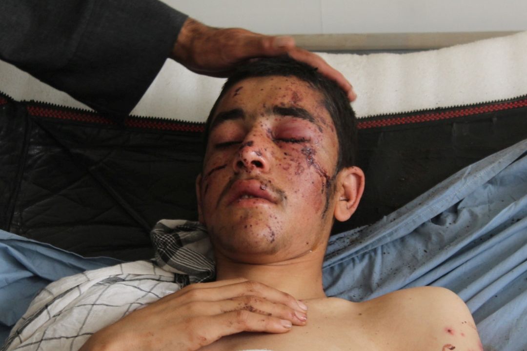 Afghánský chlapec zraněný při náletu 