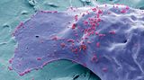 Poprvé od roku 2000 vědci odhalili nový kmen HIV