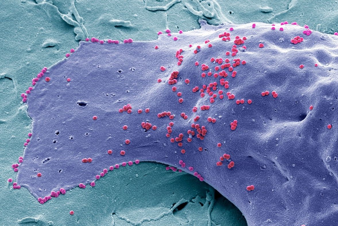 Virus HIV. Ilustrační snímek