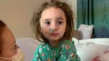 Čtyřletá dívka přišla kvůli obyčejné chřipce o zrak