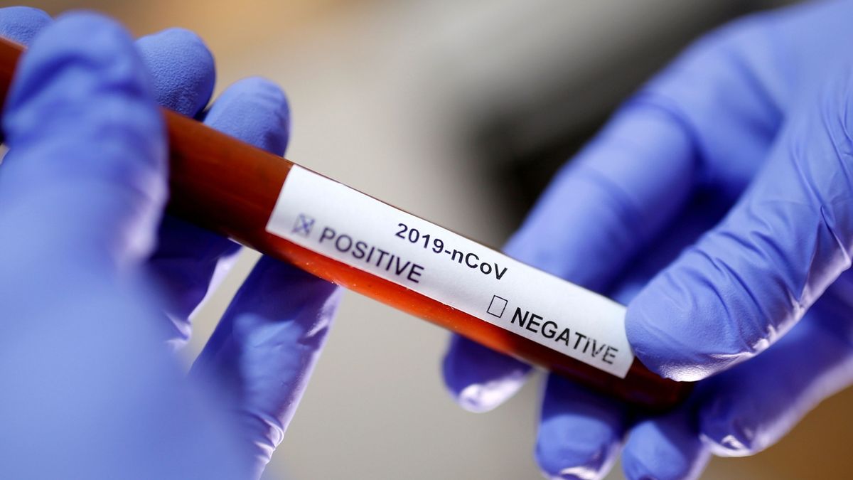 Soukromá laboratoř hlásí další pozitivní test na koronavirus