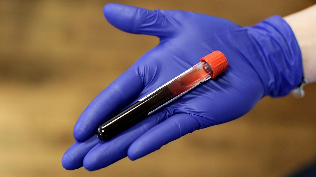 Opakované testy nepotvrdily nákazu koronavirem u lékařky opavské nemocnice