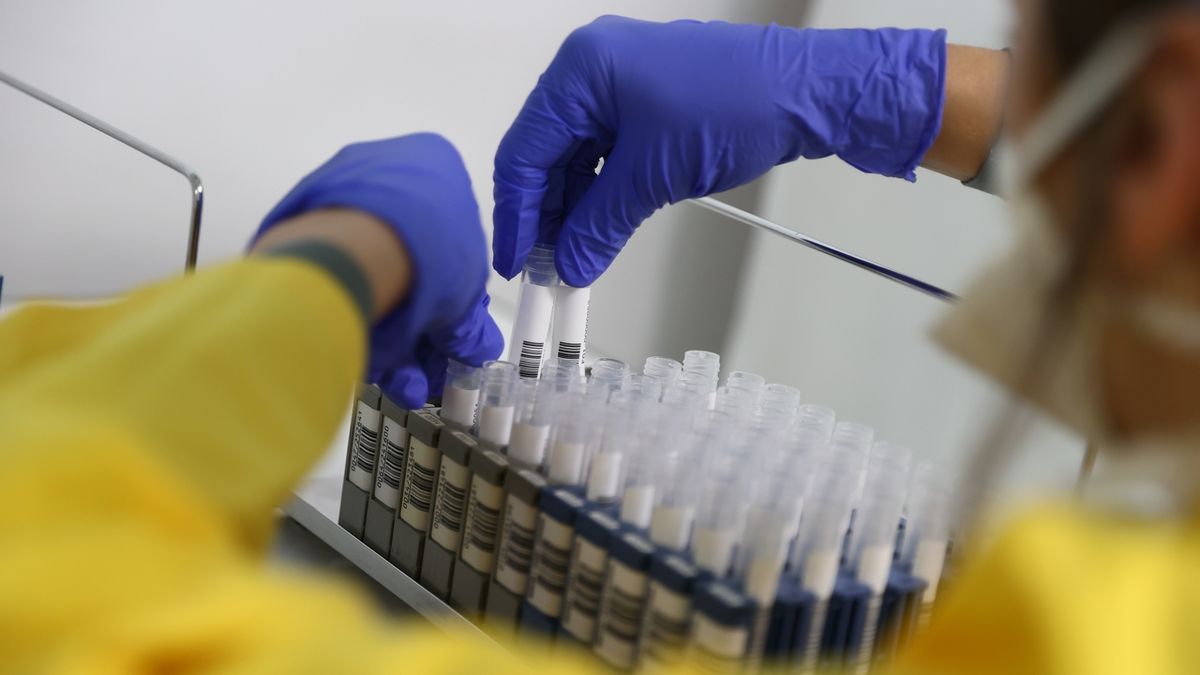 Test potvrdil koronavirus u sestry ze zlínské nemocnice